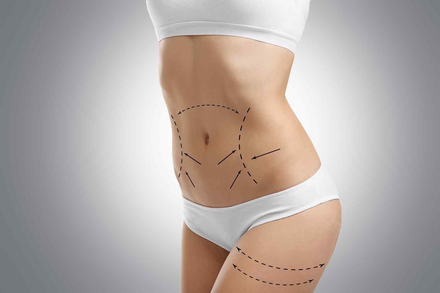 https://www.drgharbinedra.com/wp-content/uploads/2017/08/cosmetic-surgery-blog-06-1.jpg