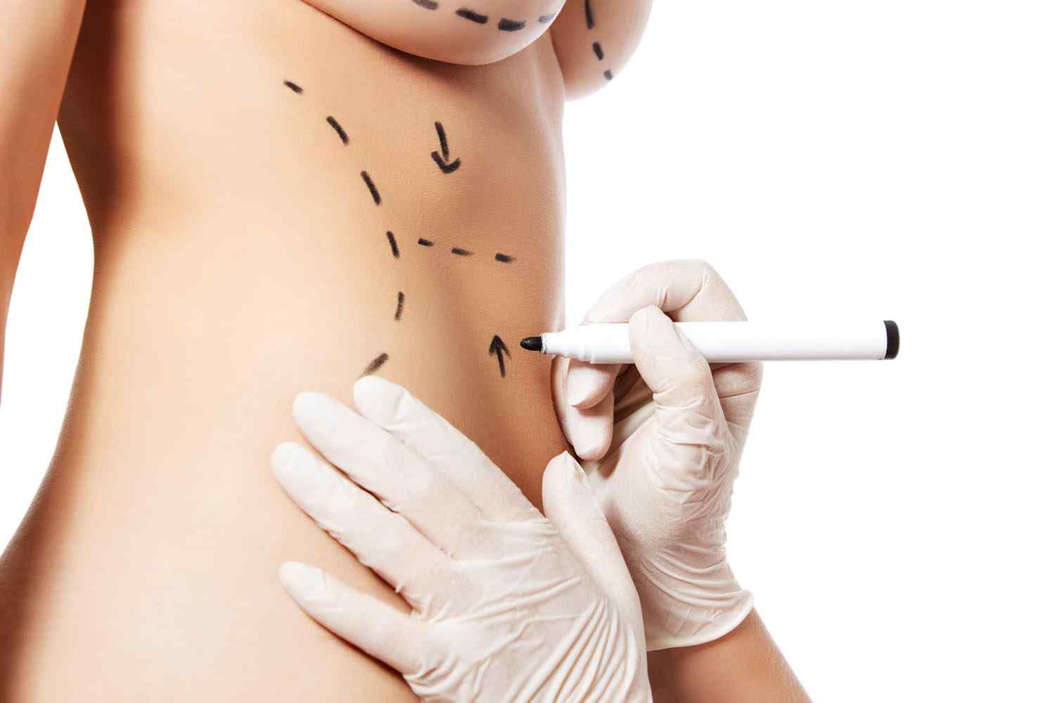 https://www.drgharbinedra.com/wp-content/uploads/2017/08/cosmetic-surgery-blog-11-1.jpg