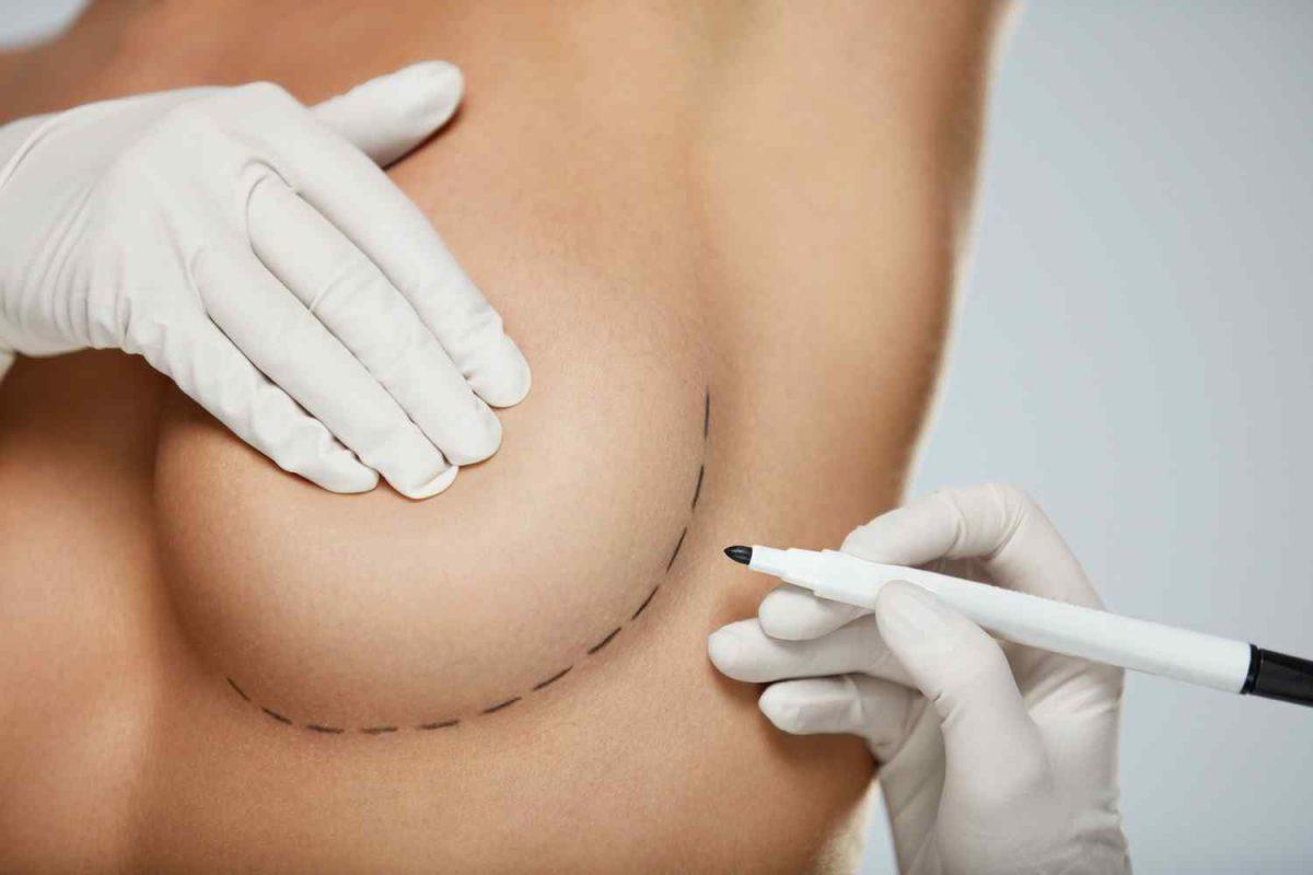 cosmetic-surgery-blog-12-1-1200x800.jpg