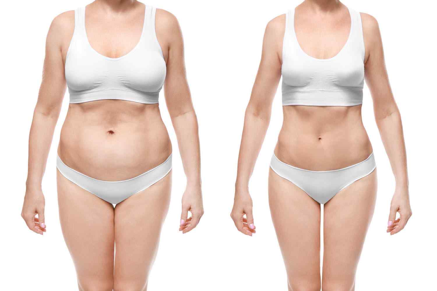 https://www.drgharbinedra.com/wp-content/uploads/2017/08/cosmetic-surgery-blog-24-1.jpg