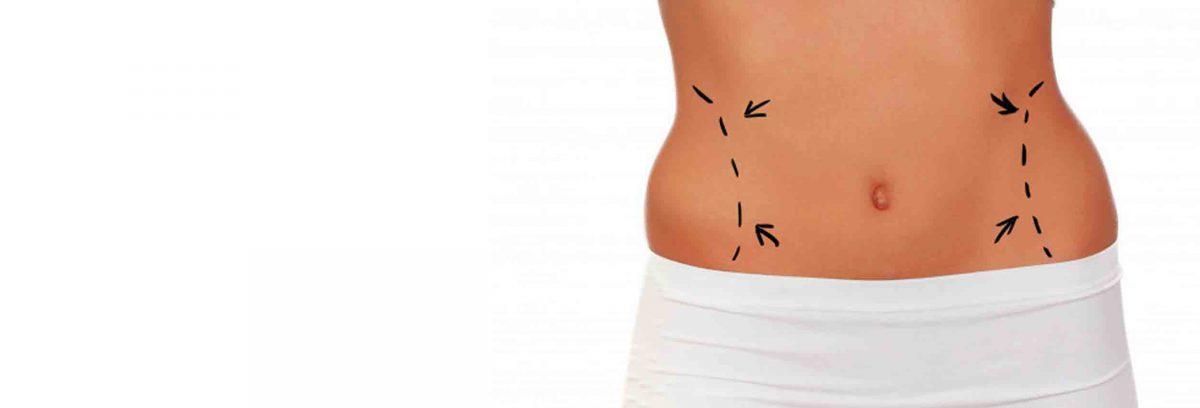 Plastie-abdominale-1200x408.jpg