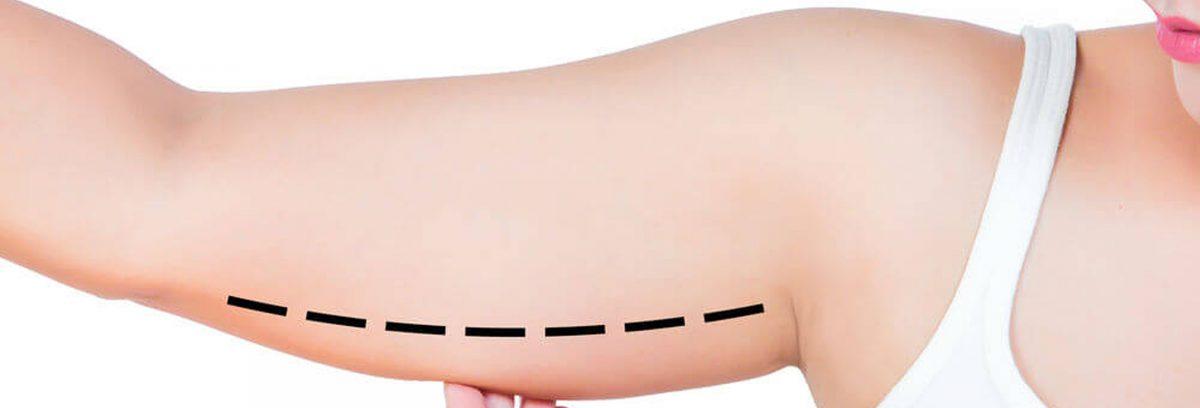 lifting-bras--1200x408.jpg