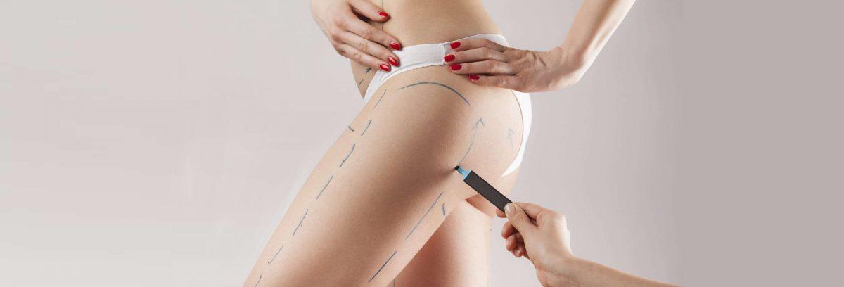 lifting-cuisses-1200x408.jpg